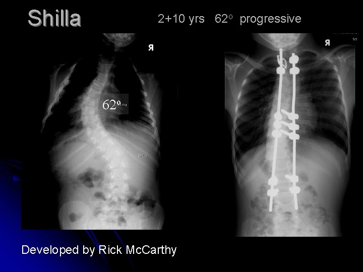 Shilla 2+10 yrs 62 o progressive 62 o Developed by Rick Mc. Carthy Shilla 2+10 yrs 62 o progressive 62 o Developed by Rick Mc. Carthy