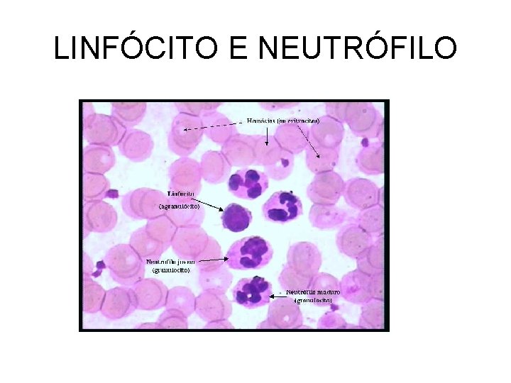 LINFÓCITO E NEUTRÓFILO 