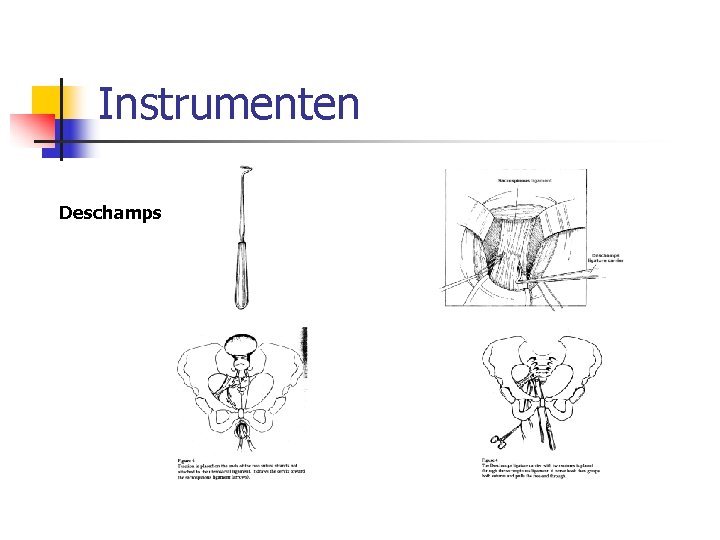 Instrumenten Deschamps 