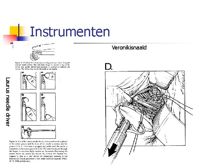 Instrumenten Veronikisnaald Laurus needle driver 