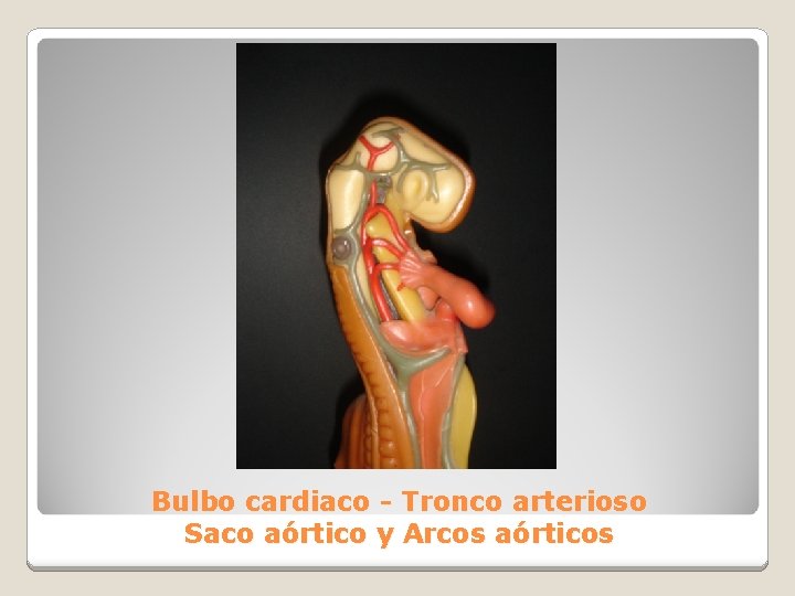 Bulbo cardiaco - Tronco arterioso Saco aórtico y Arcos aórticos 