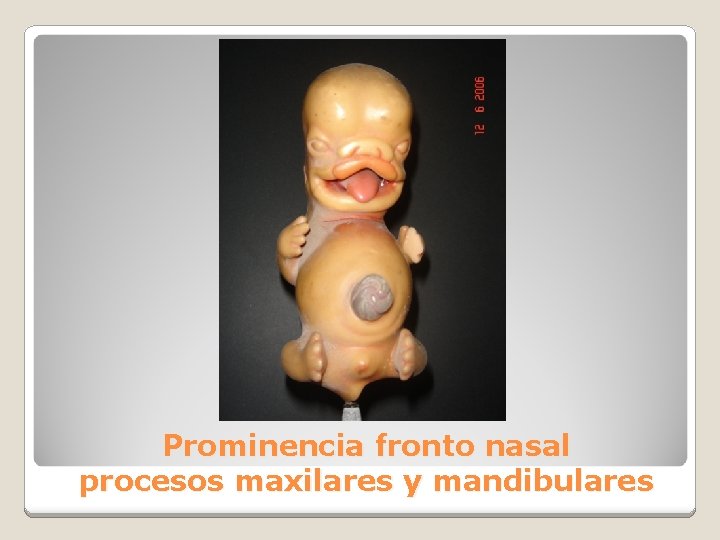 Prominencia fronto nasal procesos maxilares y mandibulares 