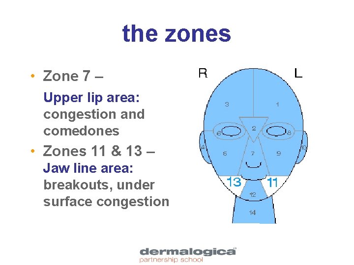 the zones • Zone 7 – Upper lip area: congestion and comedones • Zones