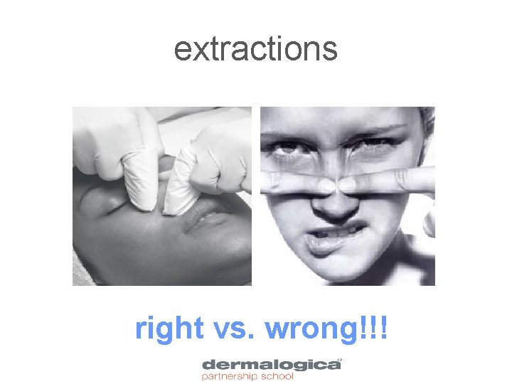 extractions right vs. wrong!!! 