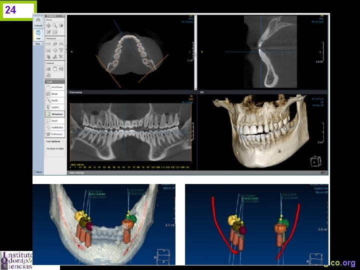 24 www. odontologico. org 