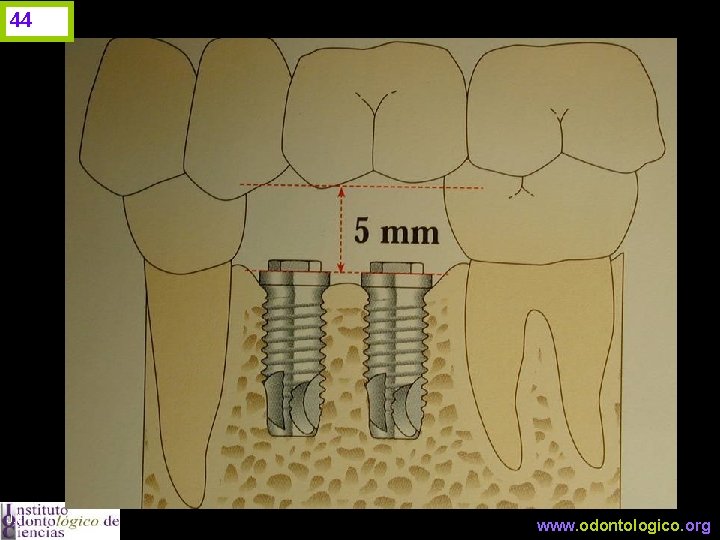 44 J. I. H. www. odontologico. org 