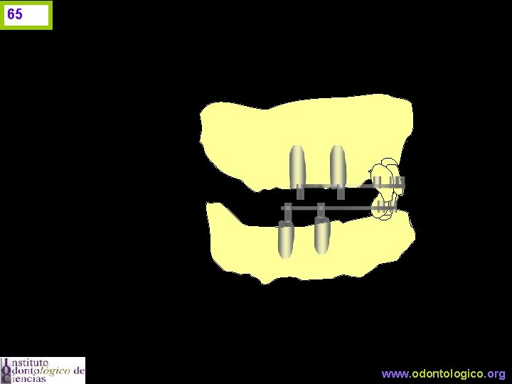 65 www. odontologico. org 