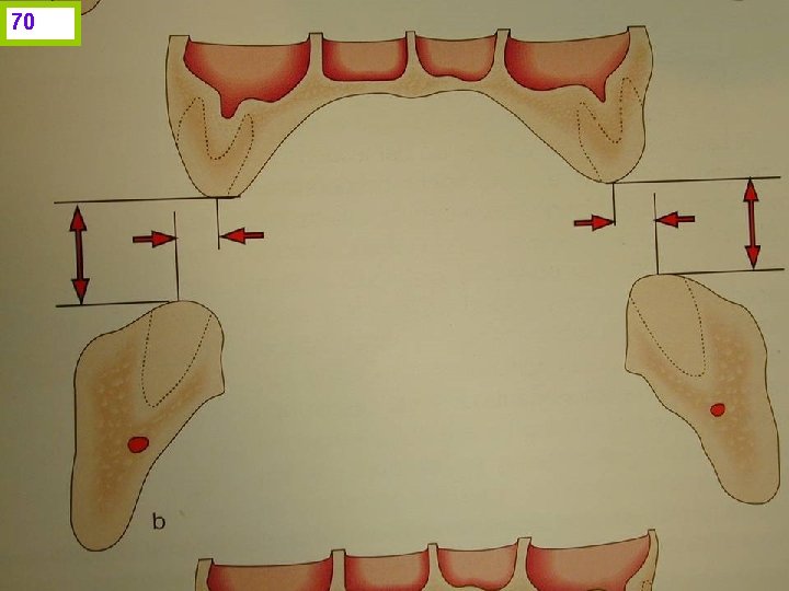 70 J. I. H. www. odontologico. org 