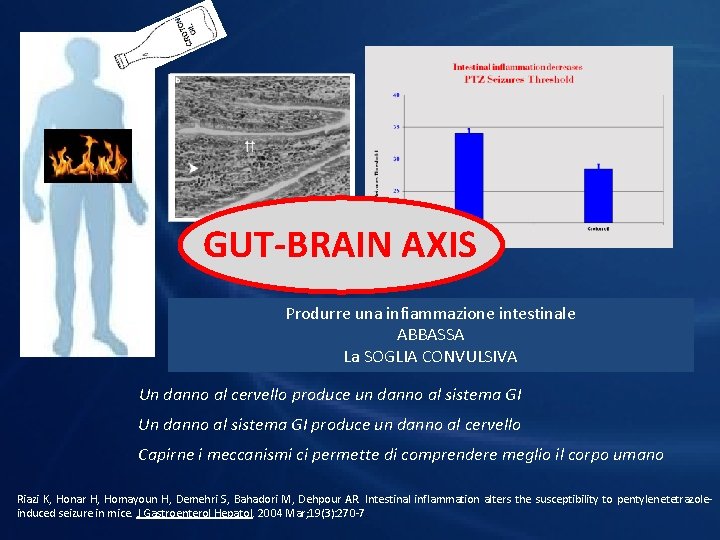 GUT-BRAIN AXIS Membrana intestinale Produrre una infiammazione intestinale ABBASSA La SOGLIA CONVULSIVA Un danno