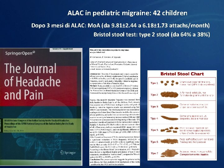 ALAC in pediatric migraine: 42 children Dopo 3 mesi di ALAC: Mo. A (da