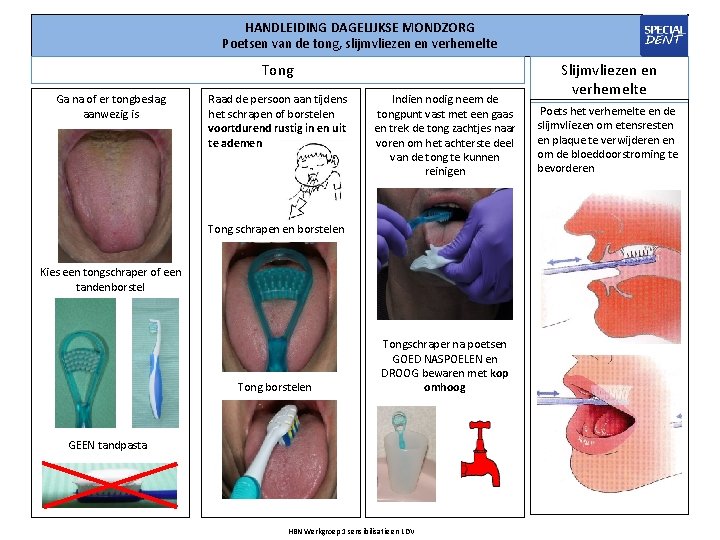 HANDLEIDING DAGELIJKSE MONDZORG Poetsen van de tong, slijmvliezen en verhemelte Tong Ga na of