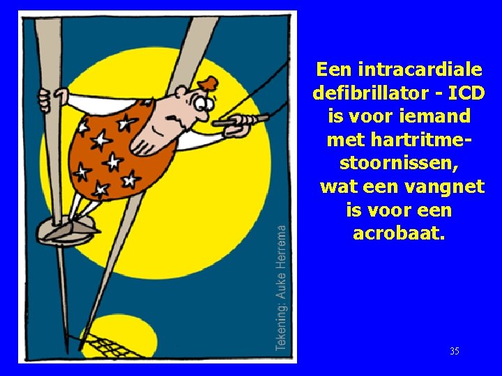 Een intracardiale defibrillator - ICD is voor iemand met hartritmestoornissen, wat een vangnet is