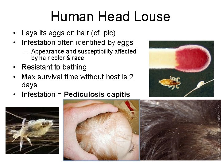 Human Head Louse • Lays its eggs on hair (cf. pic) • Infestation often