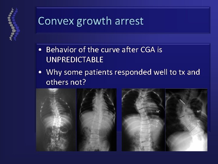 Convex growth arrest • Behavior of the curve after CGA is UNPREDICTABLE • Why
