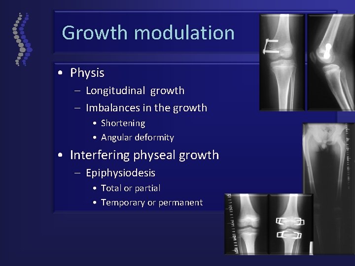 Growth modulation • Physis – Longitudinal growth – Imbalances in the growth • Shortening