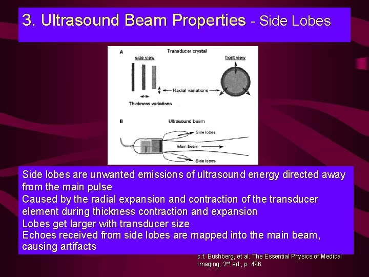 3. Ultrasound Beam Properties - Side Lobes Side lobes are unwanted emissions of ultrasound