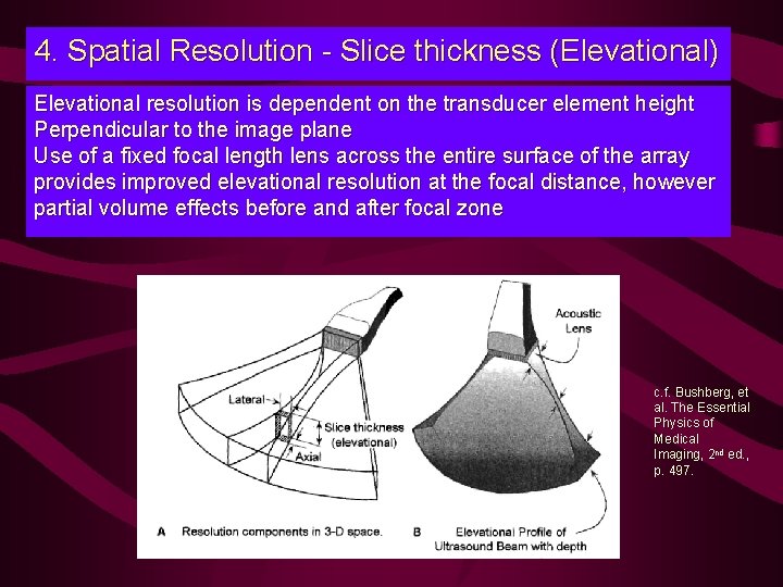 4. Spatial Resolution - Slice thickness (Elevational) Elevational resolution is dependent on the transducer