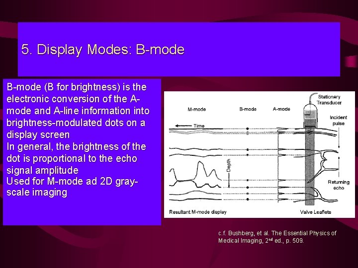 5. Display Modes: B-mode (B for brightness) is the electronic conversion of the Amode