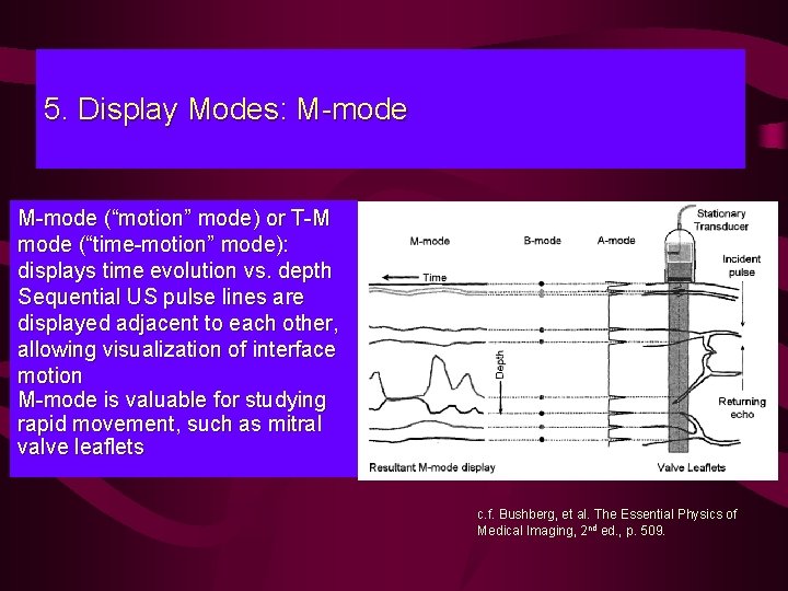 5. Display Modes: M-mode (“motion” mode) or T-M mode (“time-motion” mode): displays time evolution