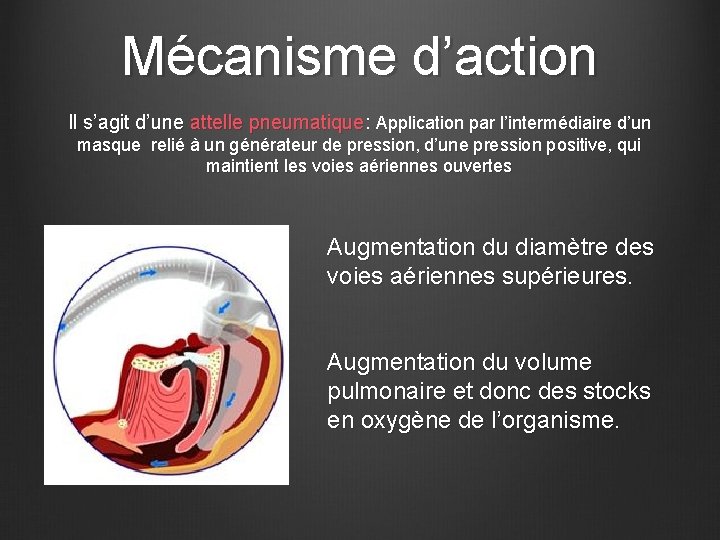 Les Traitements du SAS 1 Syndrome dApnees Hypopnes