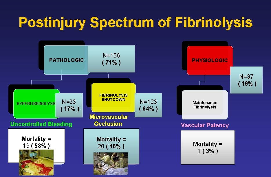 Postinjury Spectrum of Fibrinolysis PATHOLOGIC N=156 ( 71% ) PHYSIOLOGIC N=37 ( 19% )