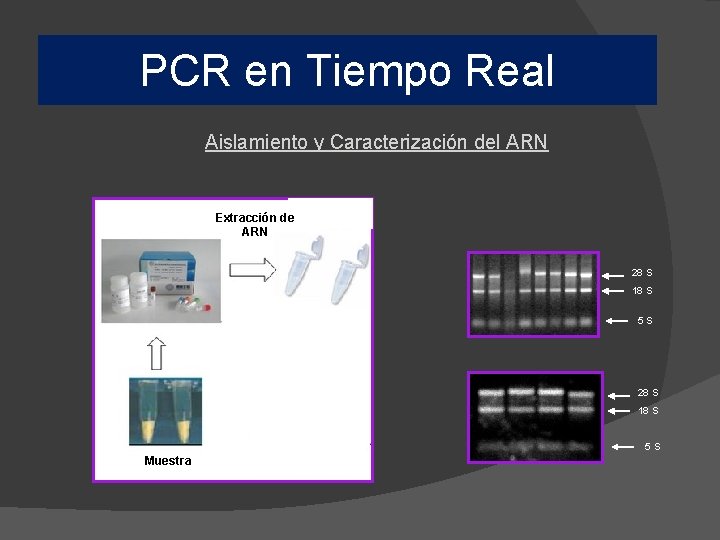 en tiempo real Real PCR en. PCRTiempo Aislamiento y Caracterización del ARN Extracción de