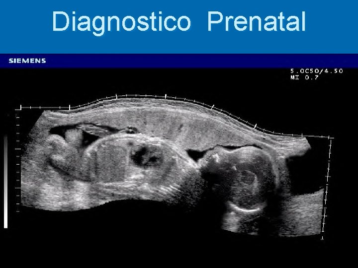 Diagnostico Prenatal 