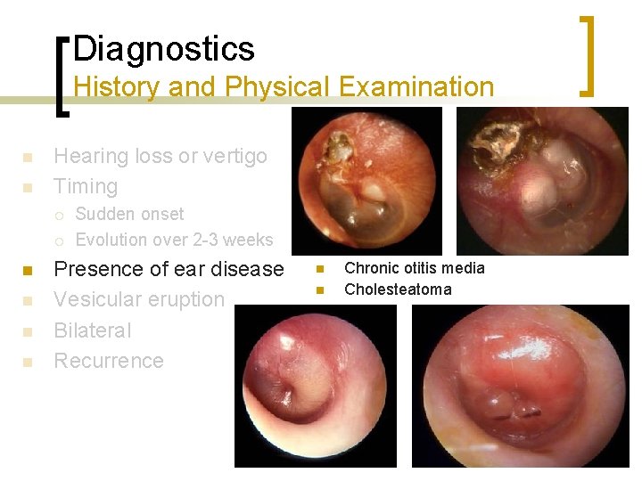 Diagnostics History and Physical Examination n n Hearing loss or vertigo Timing ¡ ¡