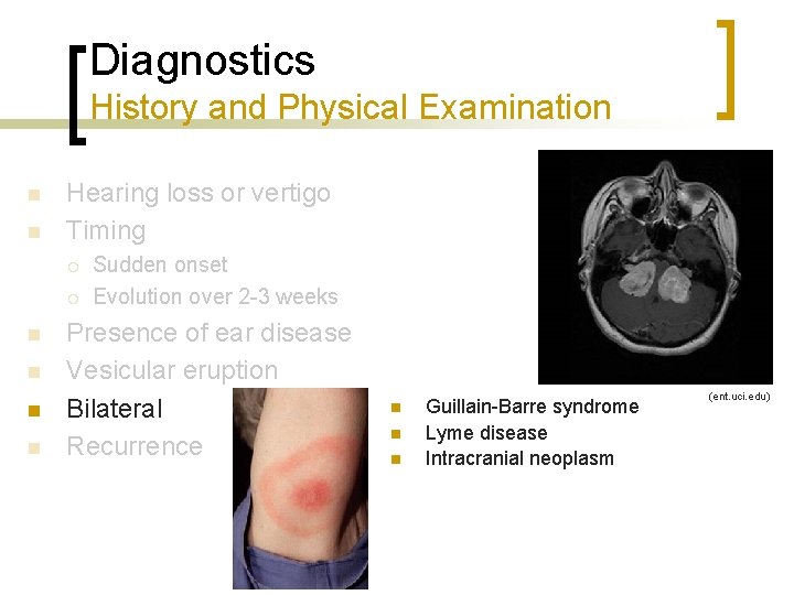 Diagnostics History and Physical Examination n n Hearing loss or vertigo Timing ¡ ¡