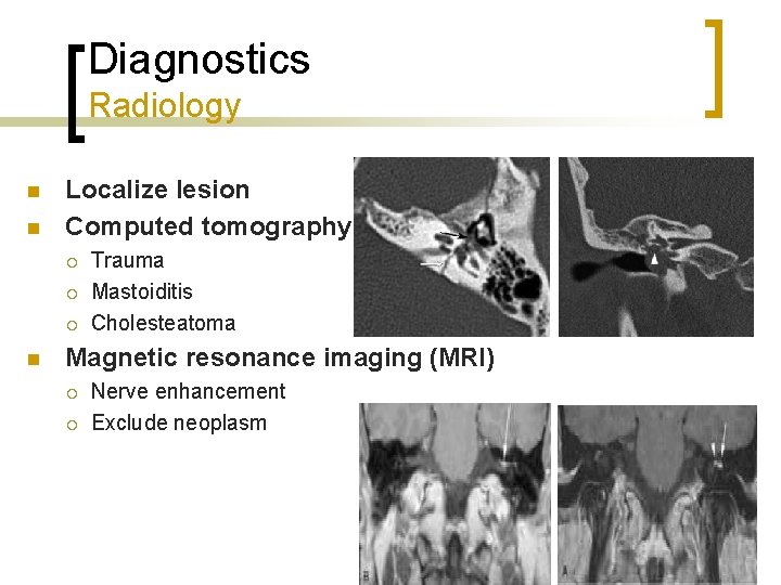 Diagnostics Radiology n n Localize lesion Computed tomography ¡ ¡ ¡ n Trauma Mastoiditis