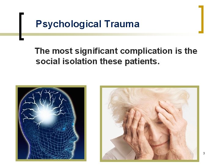 Psychological Trauma The most significant complication is the social isolation these patients. 3 