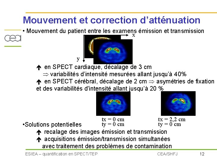 Mouvement et correction d’atténuation • Mouvement du patient entre les examens émission et transmission