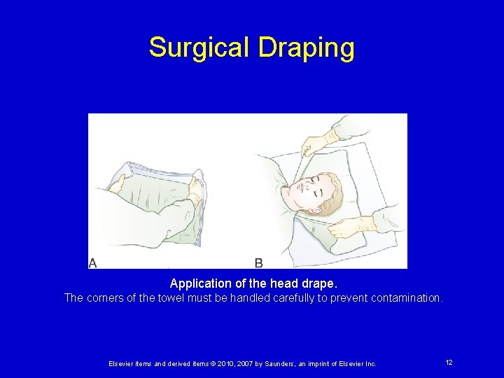 Surgical Draping Application of the head drape. The corners of the towel must be