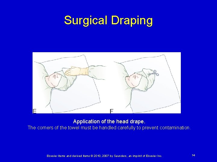 Surgical Draping Application of the head drape. The corners of the towel must be