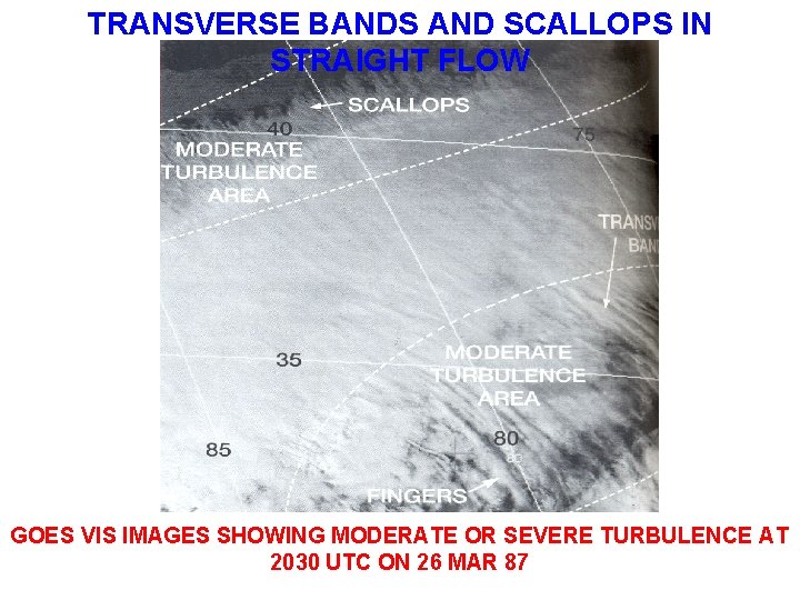 TRANSVERSE BANDS AND SCALLOPS IN STRAIGHT FLOW GOES VIS IMAGES SHOWING MODERATE OR SEVERE