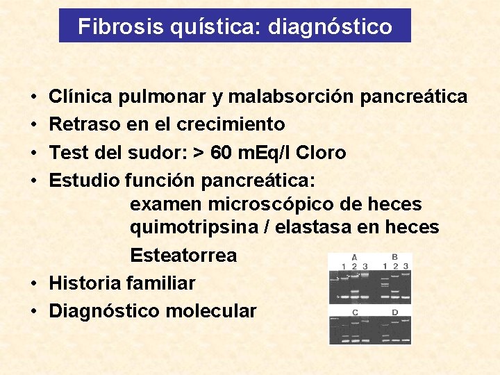 Fibrosis quística: diagnóstico • • Clínica pulmonar y malabsorción pancreática Retraso en el crecimiento