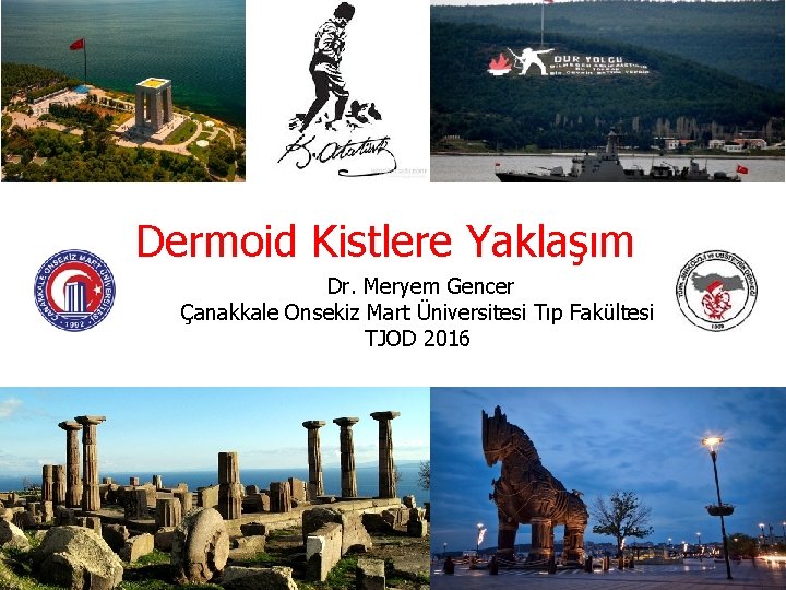 Dermoid Kistlere Yaklaşım Dr. Meryem Gencer Çanakkale Onsekiz Mart Üniversitesi Tıp Fakültesi TJOD 2016