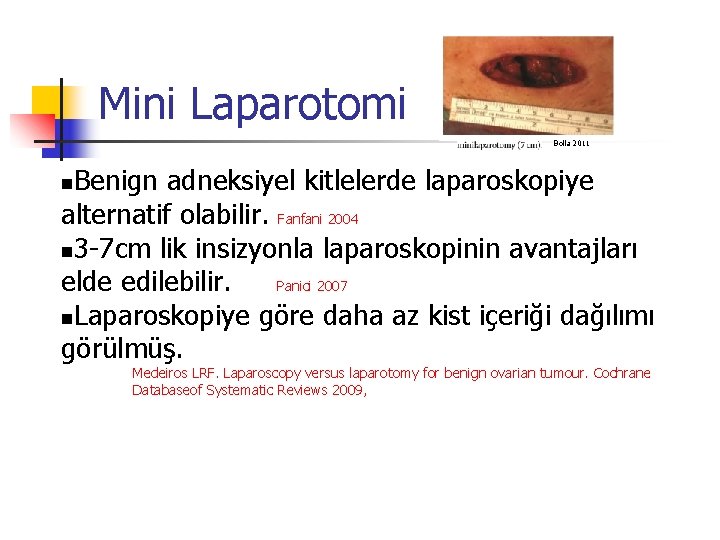 Mini Laparotomi Bolla 2011 Benign adneksiyel kitlelerde laparoskopiye alternatif olabilir. Fanfani 2004 3 -7