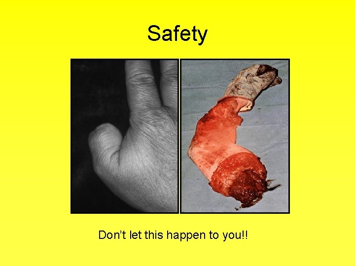 Safety Don’t let this happen to you!! 