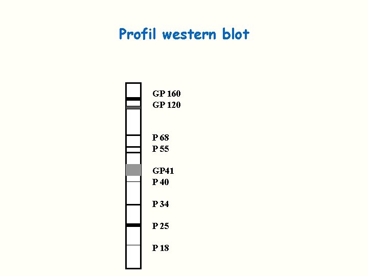 Profil western blot GP 160 GP 120 P 68 P 55 GP 41 P