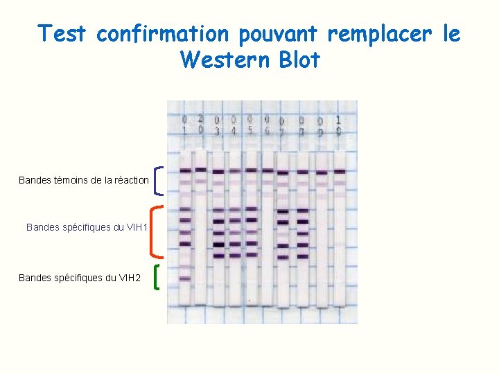 Test confirmation pouvant remplacer le Western Blot Bandes témoins de la réaction Bandes spécifiques