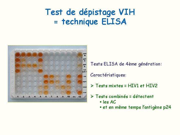 Test de dépistage VIH = technique ELISA Tests ELISA de 4ème génération: Caractéristiques: Ø