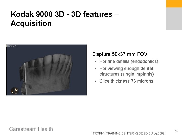 Kodak 9000 3 D - 3 D features – Acquisition Capture 50 x 37 Kodak 9000 3 D - 3 D features – Acquisition Capture 50 x 37