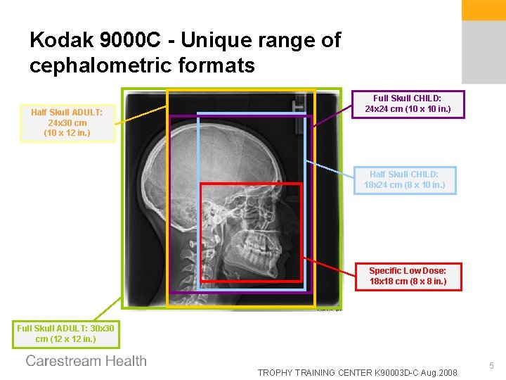 Kodak 9000 C - Unique range of cephalometric formats Half Skull ADULT: 24 x