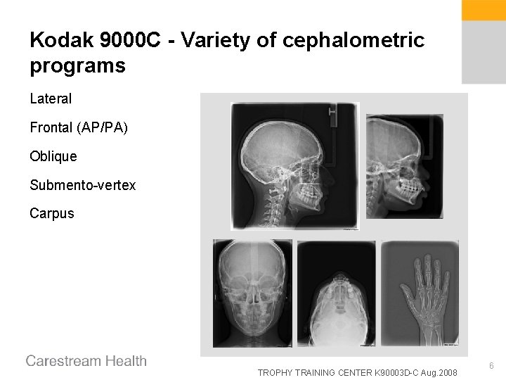 Kodak 9000 C - Variety of cephalometric programs Lateral Frontal (AP/PA) Oblique Submento-vertex Carpus