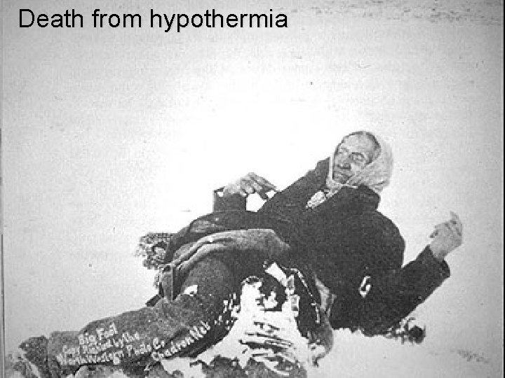 Death from hypothermia 