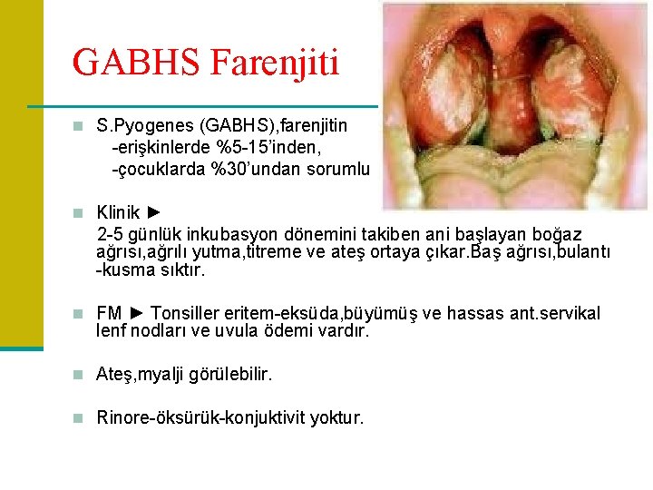 GABHS Farenjiti n S. Pyogenes (GABHS), farenjitin -erişkinlerde %5 -15’inden, -çocuklarda %30’undan sorumlu n