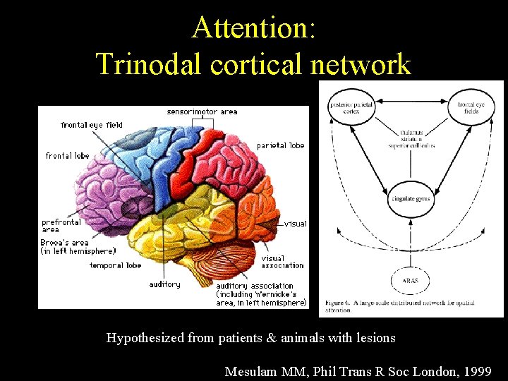 Attention: Trinodal cortical network Hypothesized from patients & animals with lesions Mesulam MM, Phil
