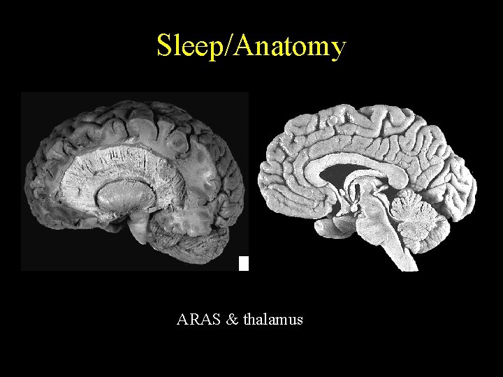 Sleep/Anatomy ARAS & thalamus 