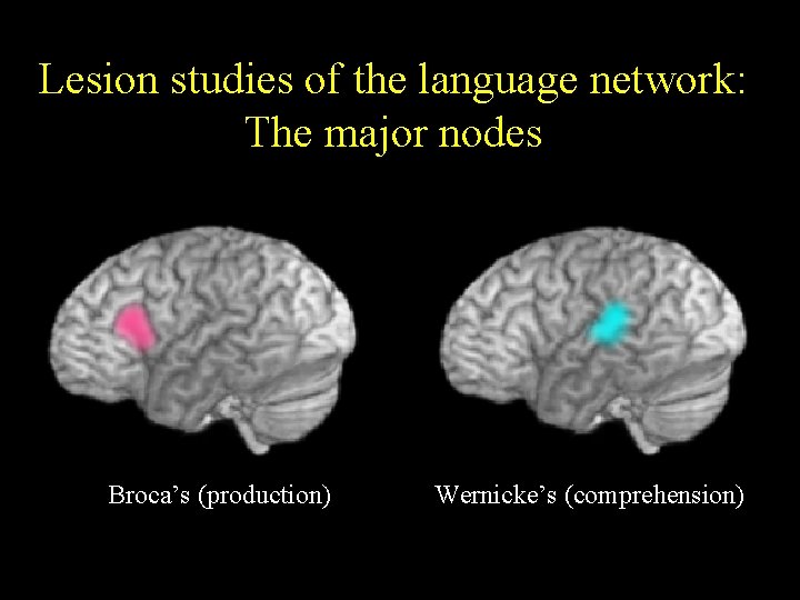 Lesion studies of the language network: The major nodes Broca’s (production) Wernicke’s (comprehension) 